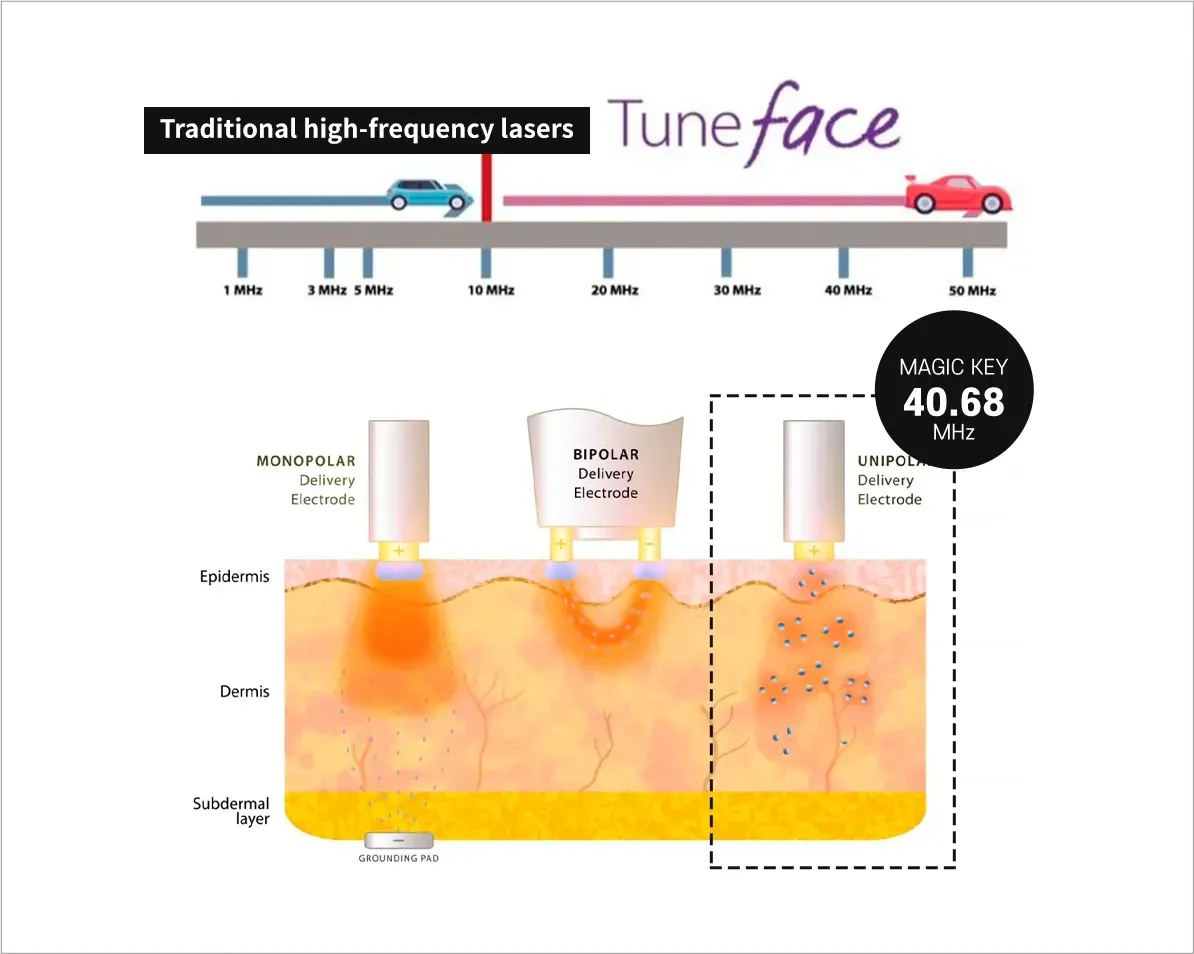 คลื่นความถี่ที่ทรงพลัง - Time Lock Tuneface