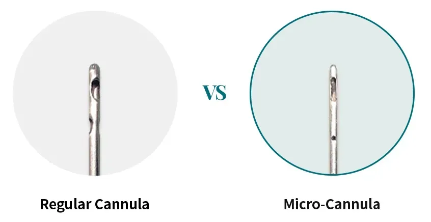 āļāļēāļĢāđāļāđ Micro-Cannula - āļāļĩāļāļĨāļāđāļāļĄāļąāļ Di-Fat āļāļĩāđ Yaan Clinic āļĒāđāļēāļāļāļąāļāļāļąāļĄ āļāļĢāļļāļāđāļāļĨ