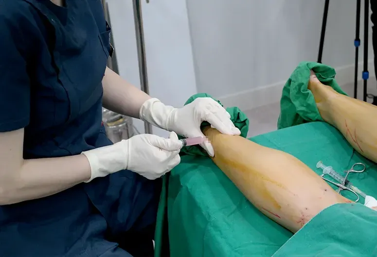 ประสบการณ์ดูแลรูปร่างและไขมันของ Yaan Clinic - ฉีดลดน่อง