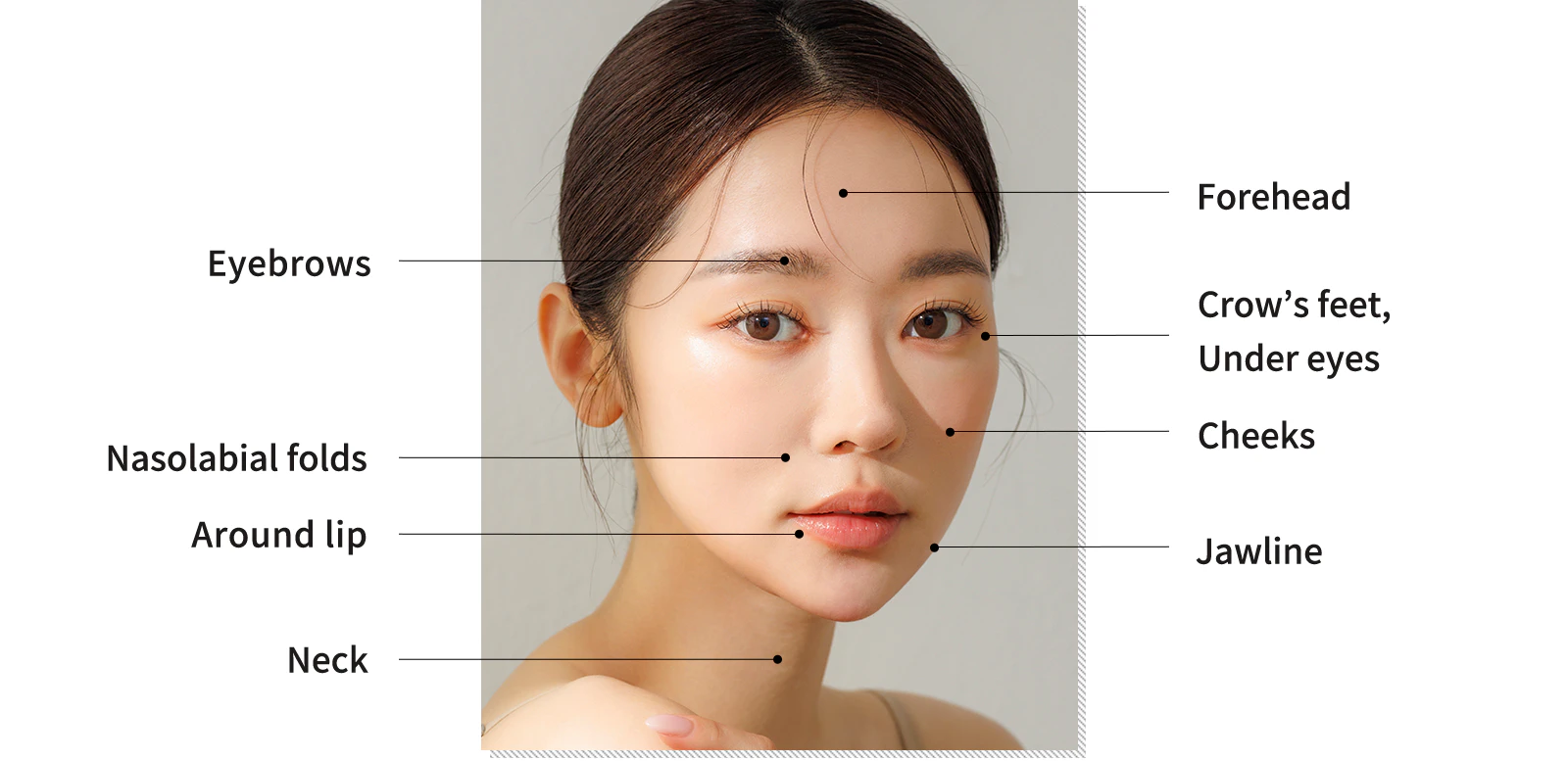 ソウル江南の Yaan Clinic の Sofwave Fit 施術部位