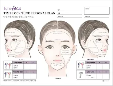 ภาพในคลินิก: ขั้นตอน Time Lock Tuneface