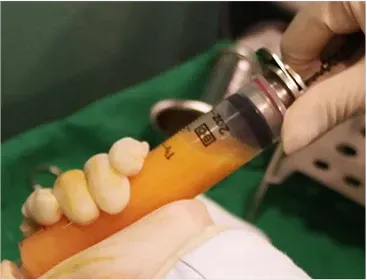 āļ āļēāļāļāļēāļāļāļąāđāļāļāļāļāļāļēāļĢāļāļĩāļāļĨāļāđāļāļĄāļąāļ Di-Fat āļāļĩāđāļāļĨāļīāļāļīāļ